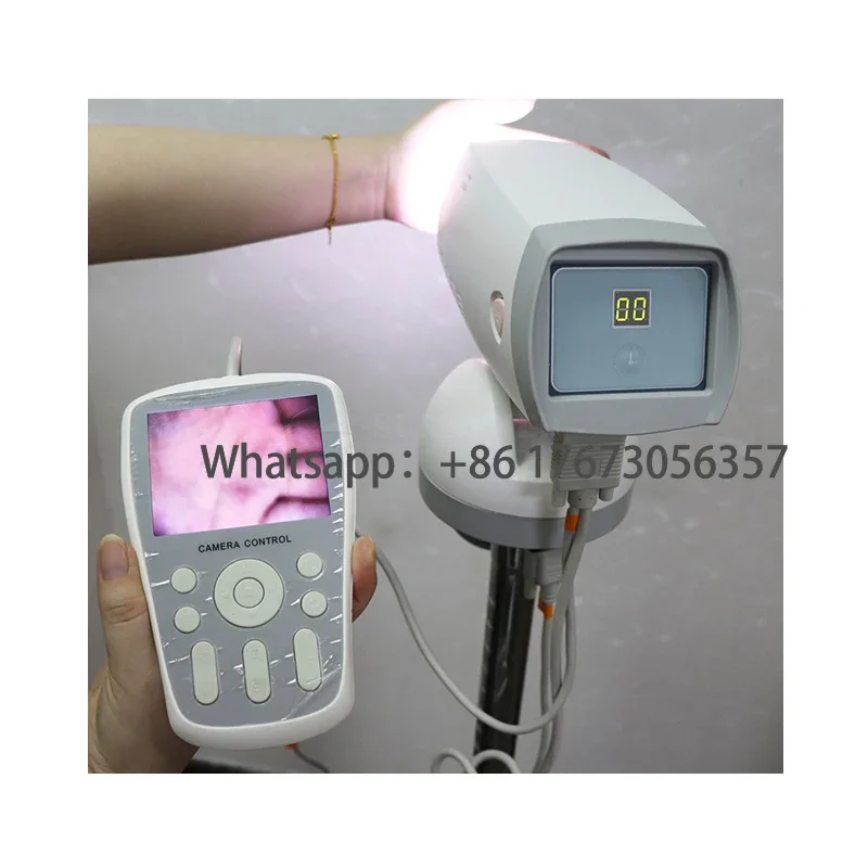 SY-F005 Clear See Цифрова ефективна електронна колпоскопия за проверка на рак на маточната шийка и здравето на жената