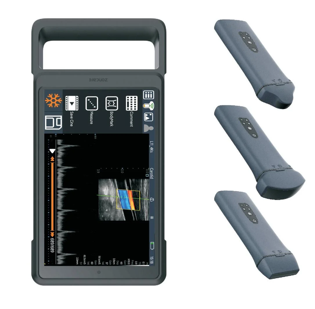 Цветен доплер изображение преносим ръчен ултразвук USB ултразвукова сонда сменяема изпъкнала сонда медицински ултразвукови инструменти